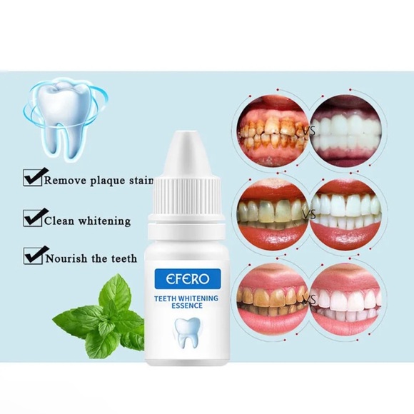 Teeth whitening portable whitening  pen guaranteed whitening in less than a week - Picture 5 of 10